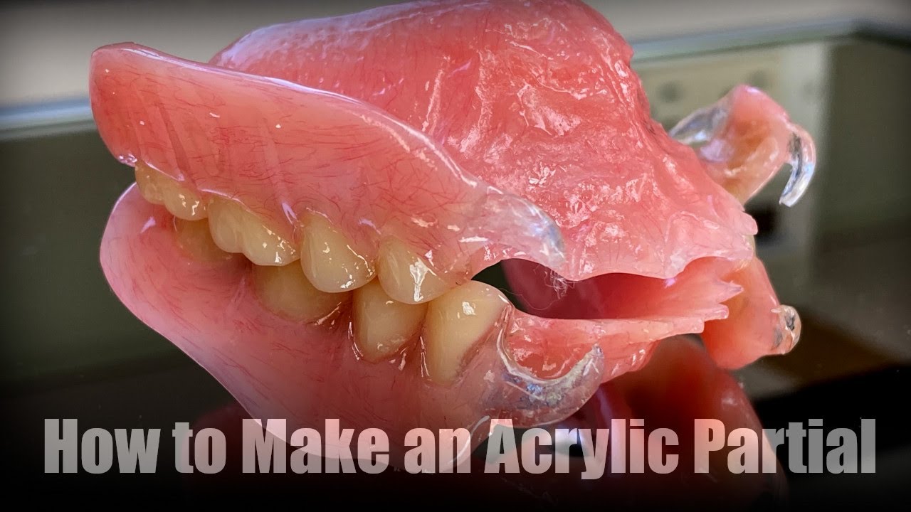 How to Make a Partial Denture  