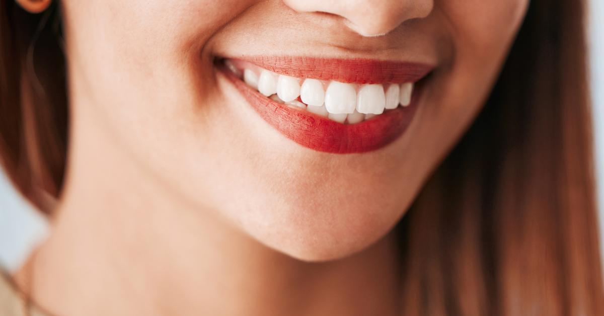 cosmetic teeth whitening