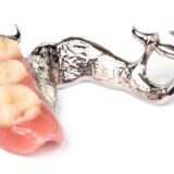 How Long Do Partial Dentures Last