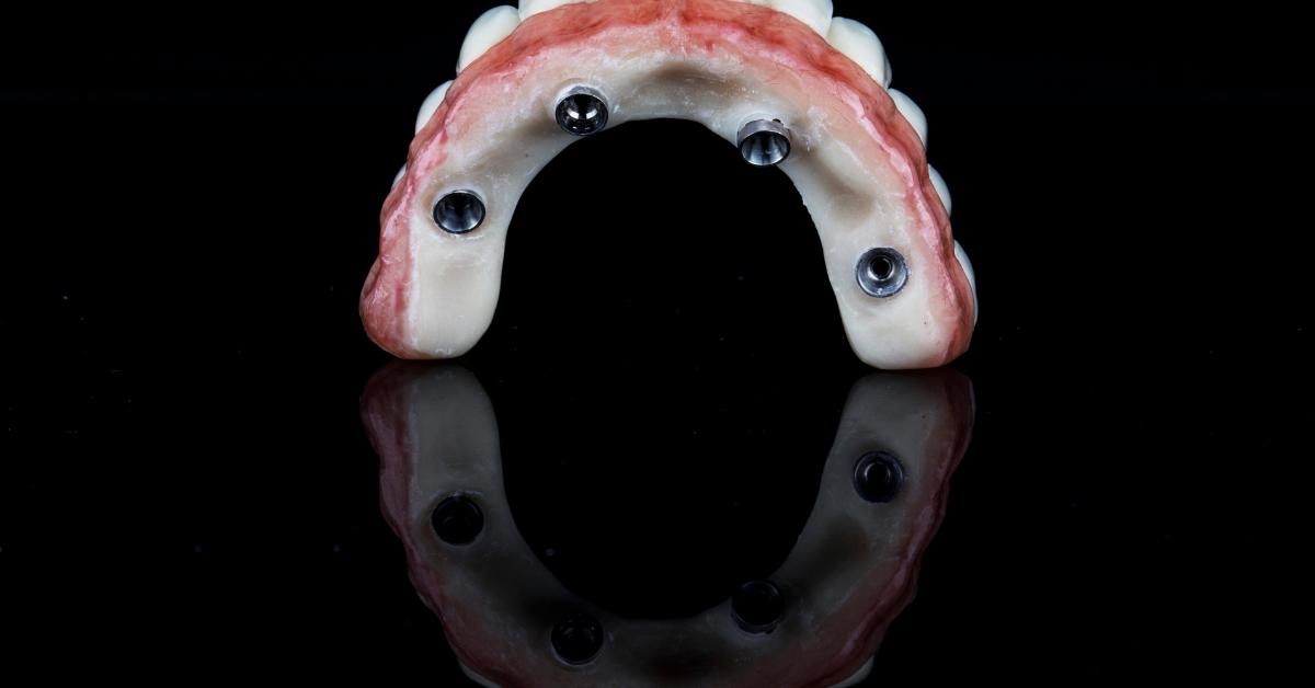 All-on-Four Dental Implants