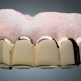 Gold denture teeth