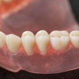 What is a denture arch