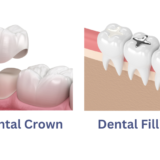 Dental crown vs filling
