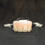 Partial dentures for front teeth