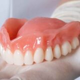 Full Mouth Extraction Immediate Dentures Pictures