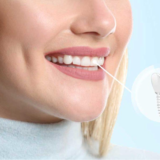 Mini dental implants