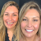 Cosmetic dentistry before and after