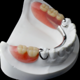 Metal partial denture