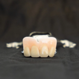 Front teeth partial dentures pictures