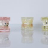 Permanent Denture Implants