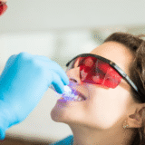 Teeth Whitening: Professional vs At-Home Treatments