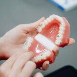 What Is the Best Age to Start Orthodontic Treatment?