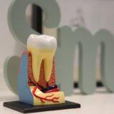 Can a Dead Tooth Be Saved?
