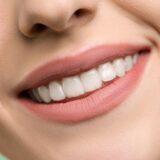 Can a Dentist Fix a Gummy Smile?