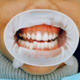 Can Receding Gums Grow Back?