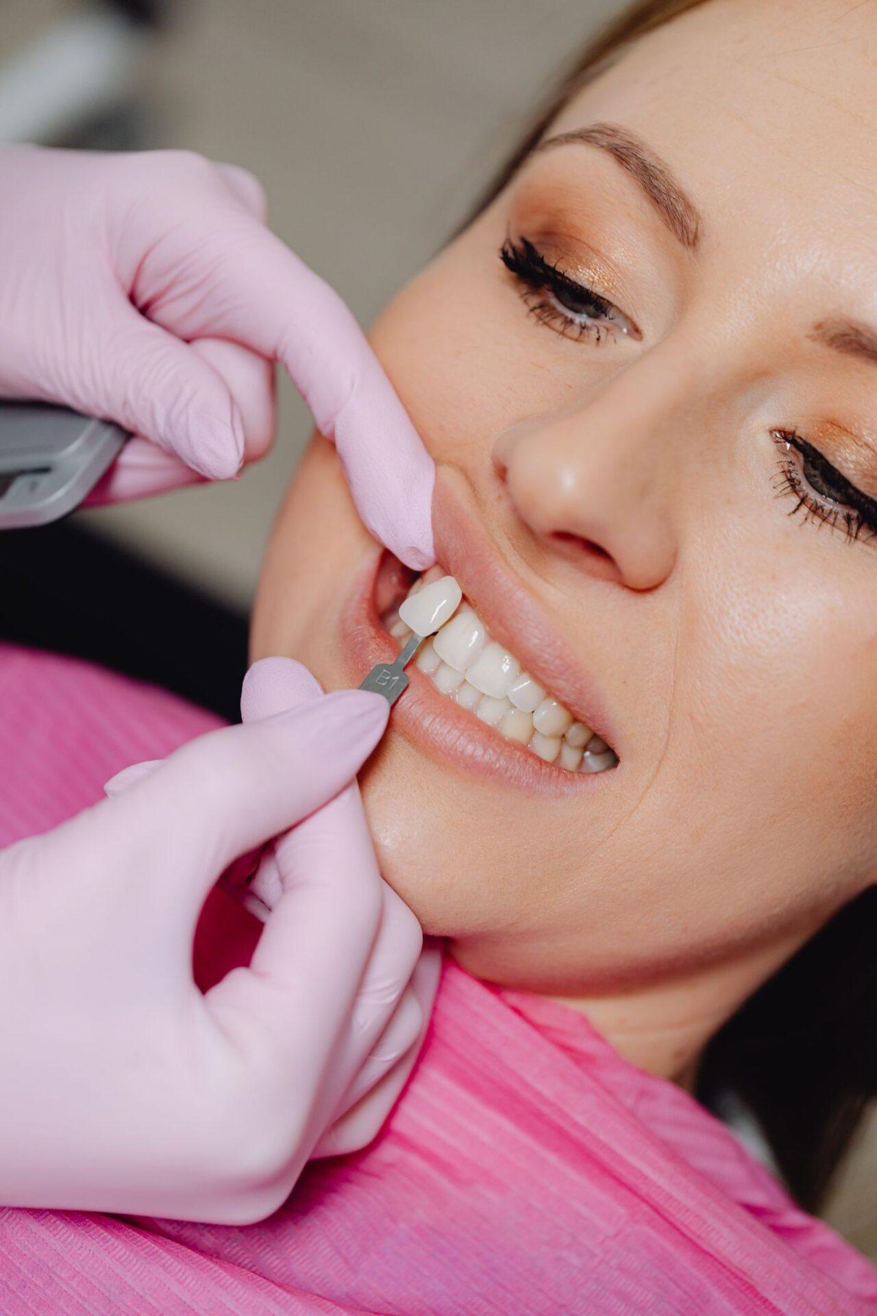 Dentist placing dental veneers in Tillsonburg at Family Dentistry on Brock
