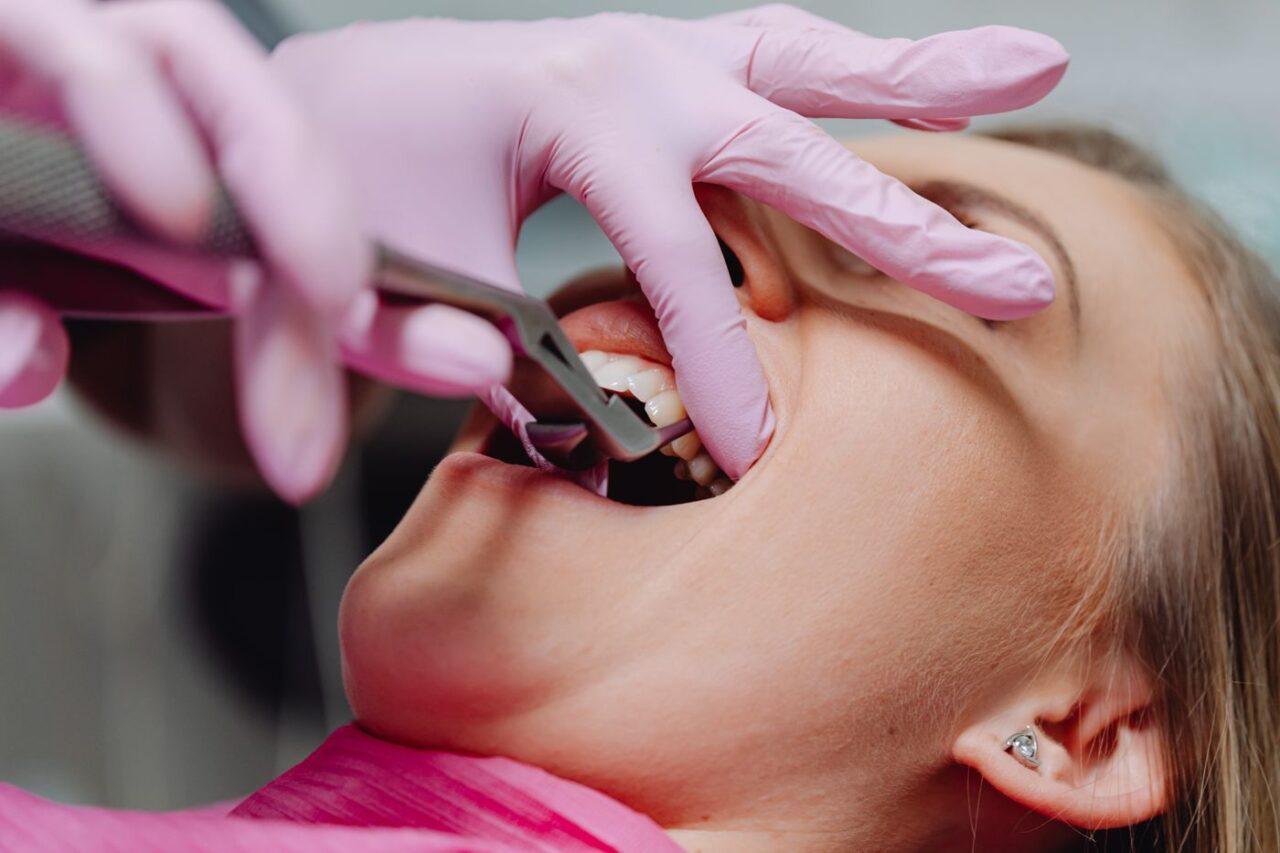 Emergency dental treatment in progress at a Tillsonburg dental office