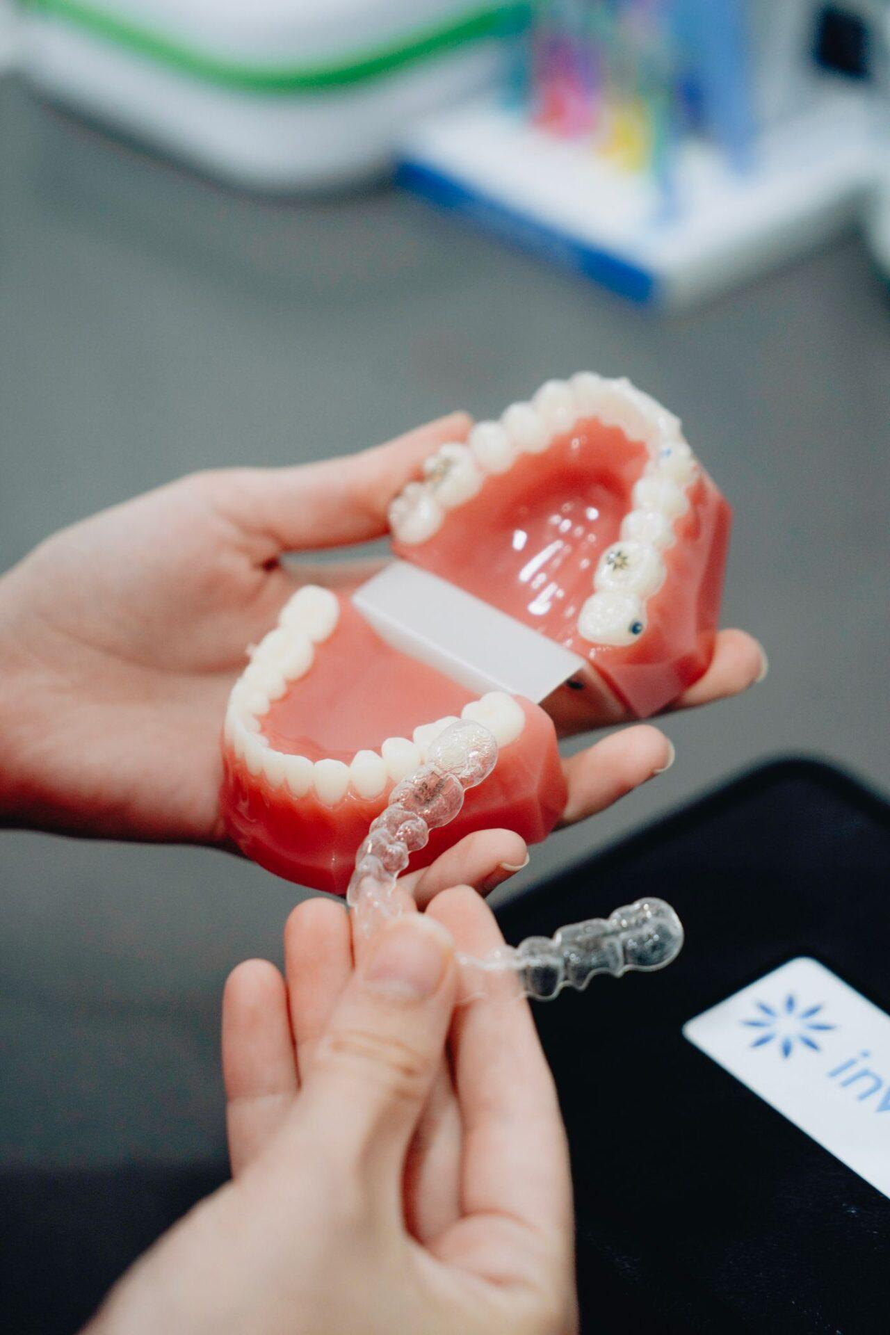 Invisalign treatment in Tillsonburg with a dental model and clear aligner
