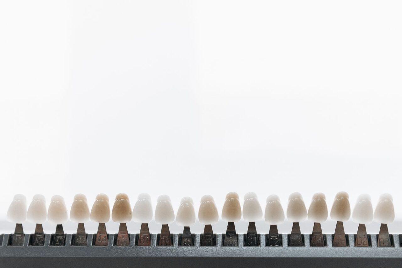 Porcelain dental veneers on display at a cosmetic dentist in Tillsonburg
