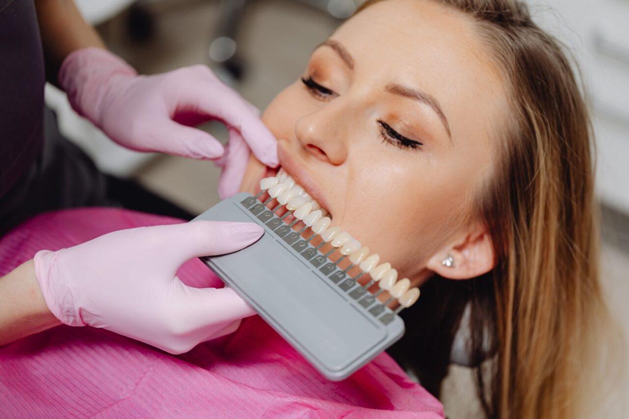 Dental shade guide used before teeth whitening in Tillsonburg
