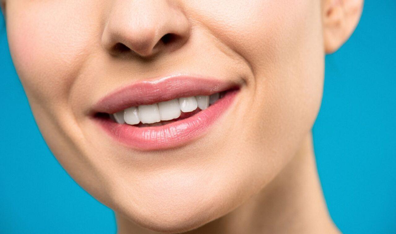 Bright smile after professional teeth whitening in Tillsonburg