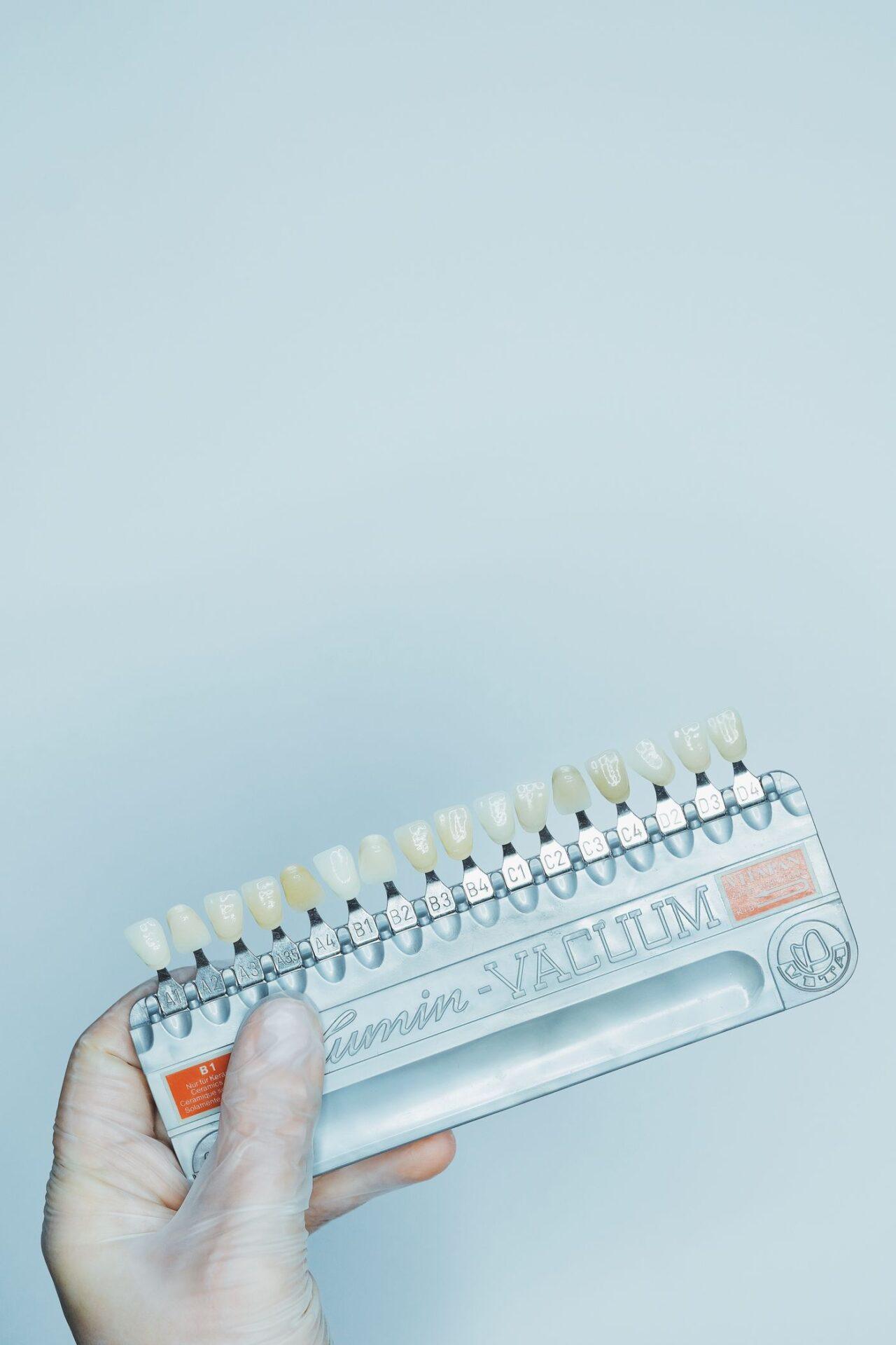 Tooth shade check for teeth whitening at a Tillsonburg dental clinic