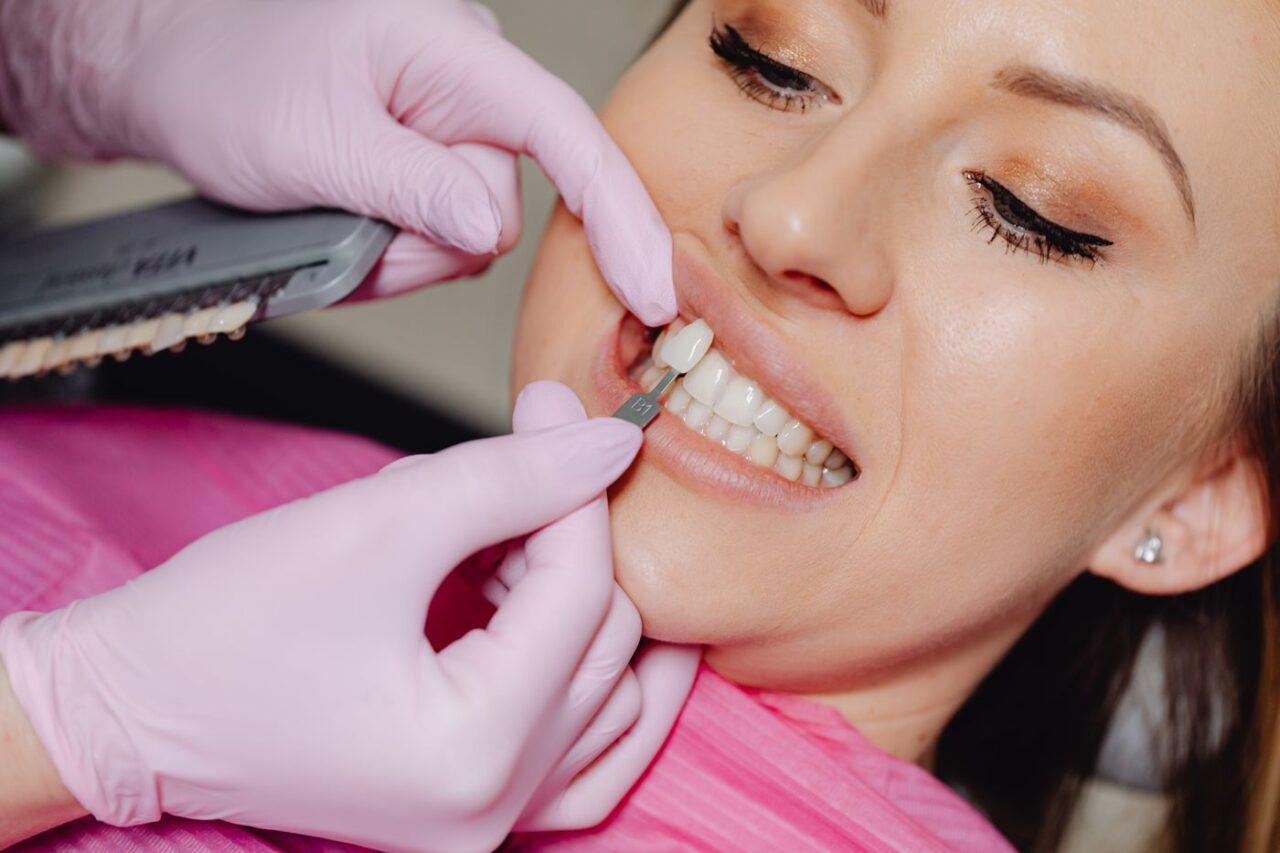 Dental veneer being applied to a patient's tooth in Tillsonburg