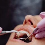 Why Does My Adult Tooth Feel Loose?